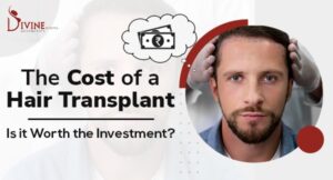 The Cost of a Hair Transplant Is it Worth the Investment