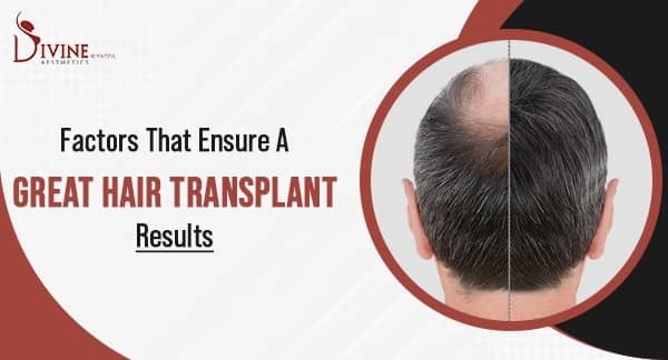 Factors-That-Ensure-a-Great-Hair-Transplant-Results