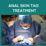 anal skin tag treatment