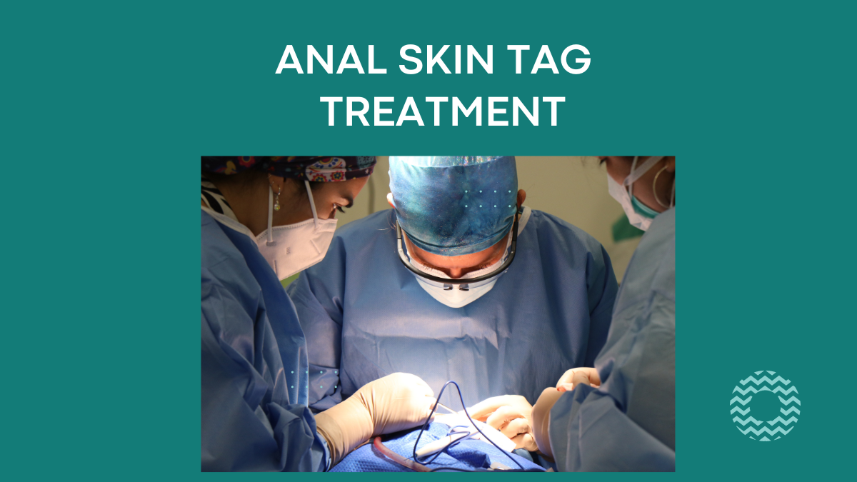 anal skin tag treatment