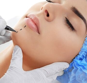 Cosmetic Surgery Tips You Need To Know About
