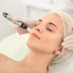 microneedle for face, micro needle treatment